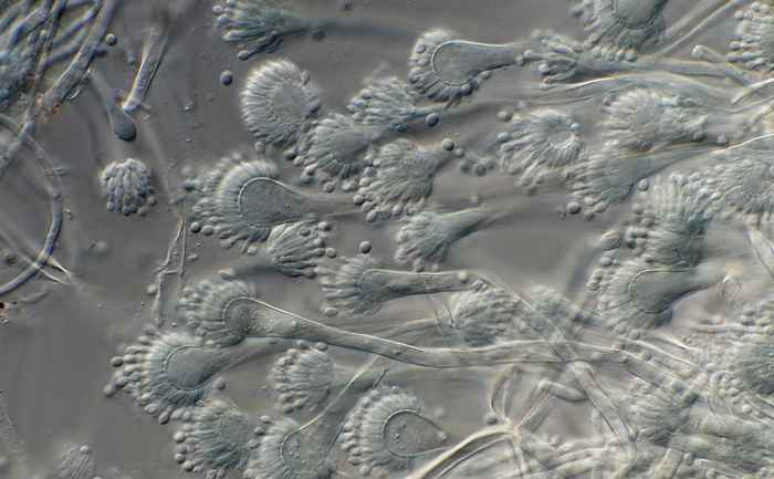 Aspergillus fumigatus, often azole resistant and difficult to treat (photo: Jos Houbraken, WI-KNAW)