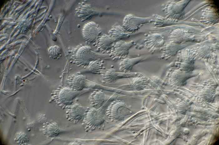 Aspergillus fumigatus, often azole resistant and difficult to treat (photo: Jos Houbraken, WI-KNAW)