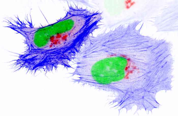 Fluorescente kankercellen